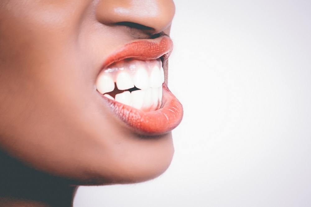 Woman with lips open to show clinched teeth