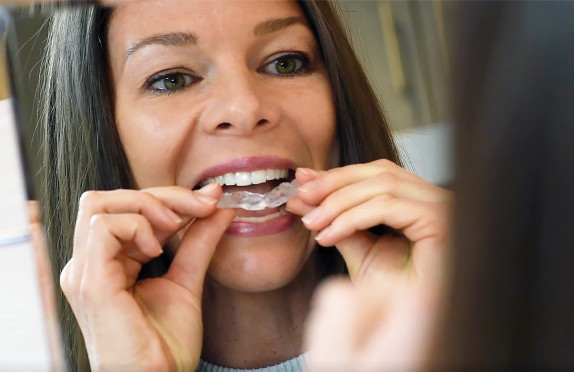 Woman inserting dental guard into mouth