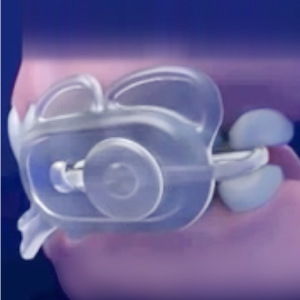 Diagram of Dental Guard proper fit between teeth